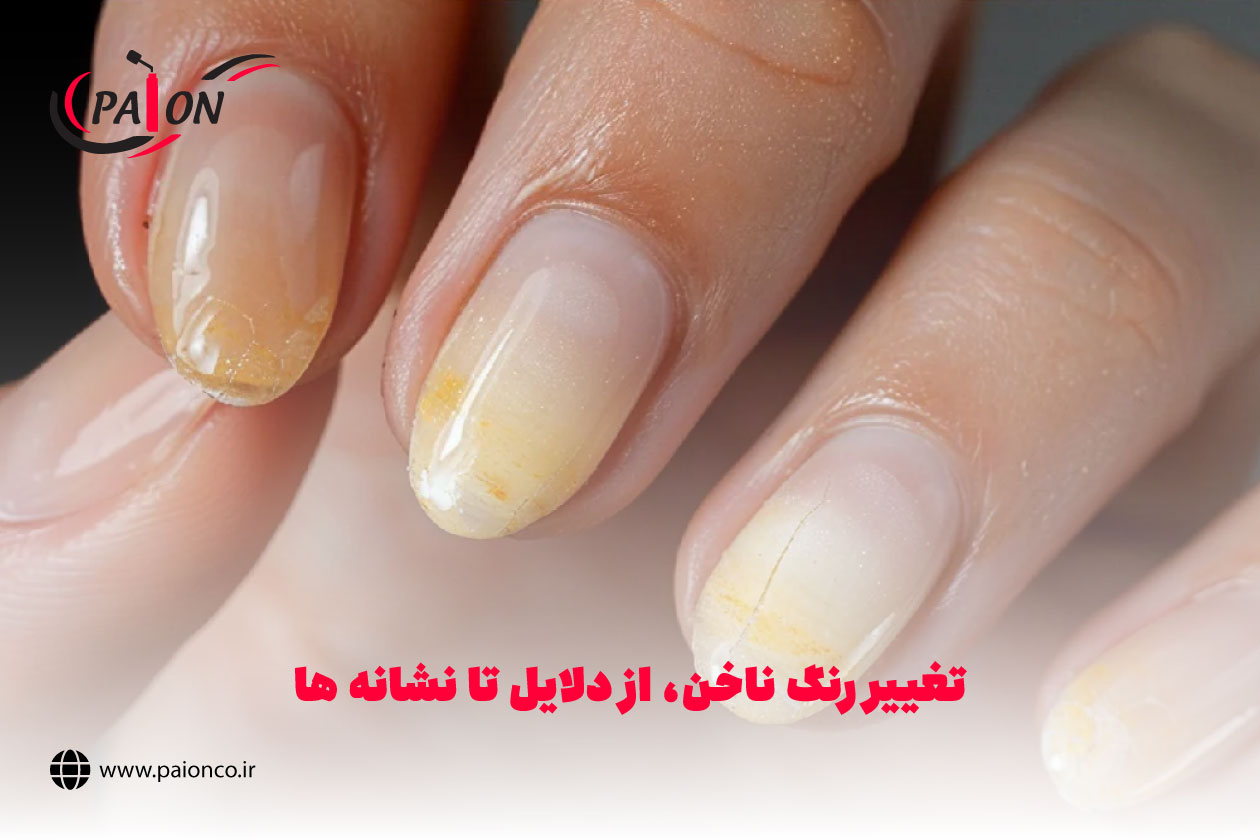 تغییر رنگ ناخن
