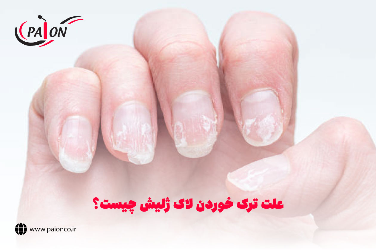 علت ترک خوردن و کنده شدن لاک ژلیش